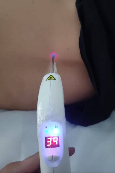 Dra. Jéssica Toreti aplicando terapia com fotobiomodulação.