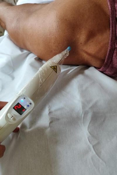 Dra. Jéssica Toreti aplicando terapia com fotobiomodulação.